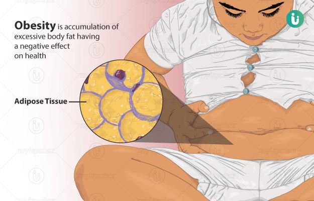 Excessive Fat Became a Danger for India: